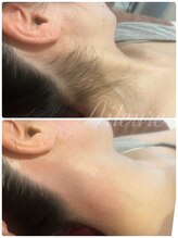 エルール トータルビューティ(Aileure total beauty)/うなじ美人