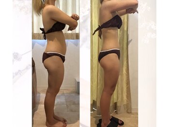 ビープロデュース 国分寺店(B' PRODUCE)/ビフォーアフター