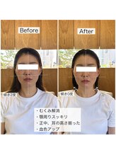 シャウルデッサン(CHARLESDESSIN)/骨格補正スパ