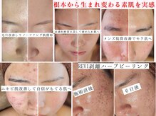 ユウビジン(YOU美人)