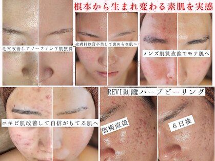 ユウビジン(YOU美人)の写真