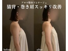 ミトラ(MITRA)/肩こり猫背・巻き肩スッキリ改善