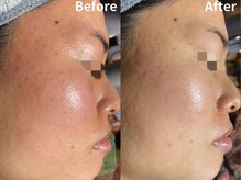 ポンディシェリ(Pondicherry)の雰囲気（毛穴、ごわつき、皮脂過多、赤ら顔◎インスタ【ポンディシェリ】）