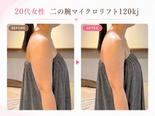 リフト 西船橋(Lift)/【西船橋】小顔・痩身専門店Lift