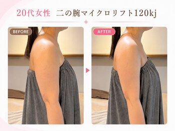 リフト 西船橋(Lift)/【西船橋】小顔・痩身専門店Lift