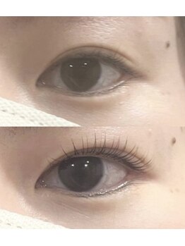 abp /ラッシュリフト