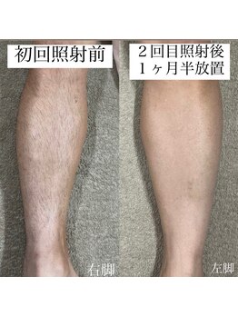 テンパ ビューティー(+10%beauty)/効果写真