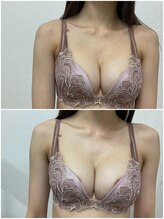 バーディー(BIRDIE)/施術１回/２０代