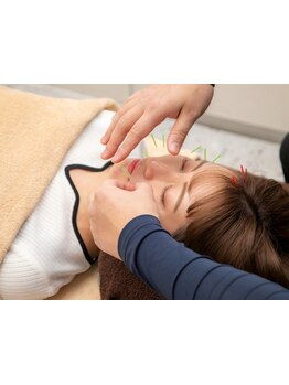 鍼灸施術を受けたい