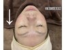 【姫路唯一】のプラズマレボリューション 超速リフトアップ 通常 17000円