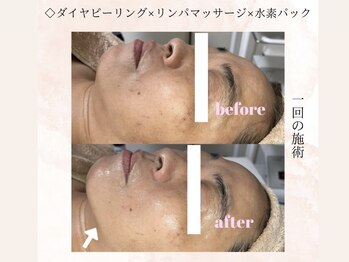 カラン(Calin)/50代お客様☆