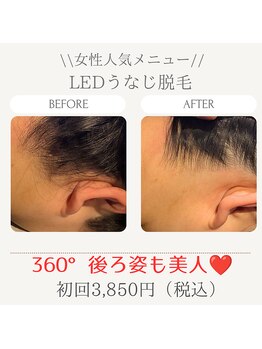 美々庵/LEDうなじ脱毛