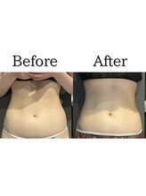 アッヴェリーレ(A'bbellire)/クールウェーブBefore / After