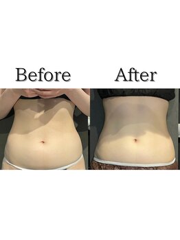 アッヴェリーレ(A'bbellire)/クールウェーブBefore / After