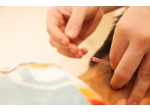 【鍼灸施術も承っております】肩こり/腰痛/頭痛/眼精疲労