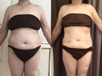 ウェリナ 一宮院/.【ダイエットbefore→after】