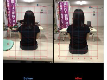 ストレチックス 近江八幡店/姿勢改善ビフォーアフター1回