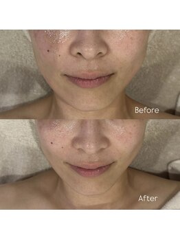 ウィール 栄 矢場町店(WE:LL)/小顔美肌フェイシャル