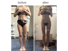 もちろん無加工！施術30回です！