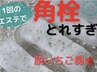 【平日限定】いちご鼻撃退★角栓・黒ずみ徹底除去 ¥12,000→ ¥9,000