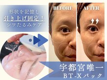 モルティー 宇都宮本店(Molti)の雰囲気(引き締め小顔矯正・たるみしわ改善にはフェイシャル生パック)