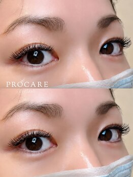 プロケア 新宿本店(PROCARE)/フラットラッシュダブル120束