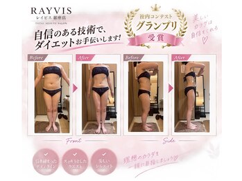 エステティック レイビス 銀座店(RAYVIS)の写真/身体を深層からしっかり温め脂肪を分解・燃焼!お悩み部分の集中ケアも対応◎冷えや浮腫み、血行も改善☆
