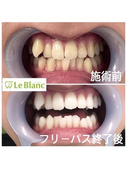 ルブラン 奈良店(Le Blanc)/駅近サロン!