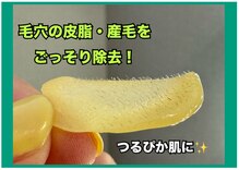 アネラ(ANELA)