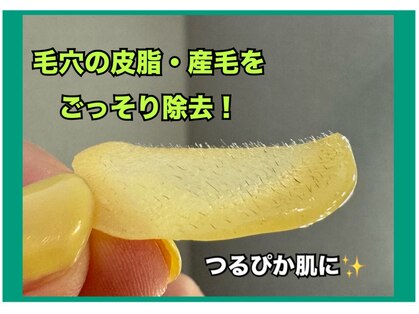 アネラ(ANELA)の写真