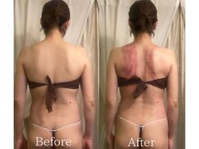 サロンハート(Salon Heart)/浦和エステ痩身/小顔/よもぎ蒸し