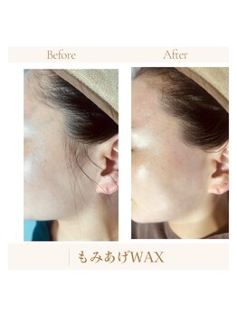 シュガーリングハウスレディ(SugaringHouse LADY)/もみあげ脱毛