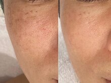 ポ ワール(Poir)/