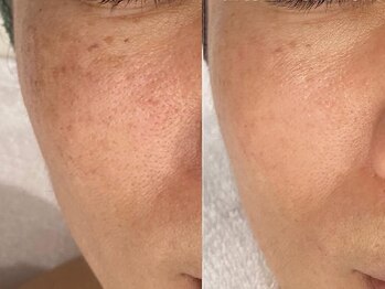 ポ ワール(Poir)/