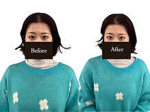 整体と美容鍼 無名/Before＆After【心斎橋/南船場】