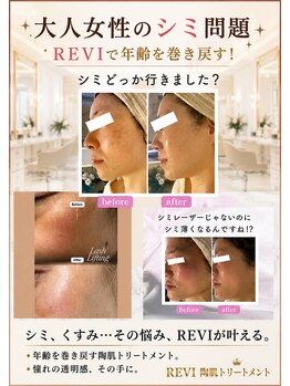 リボン(Ribbon)/くすみ、シワ問題解決