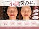 美骨小顔サロン アビー(ABBY)の写真