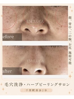 エミルカ 千葉店(EMILUCA)の写真/シミやシワにアプローチし色むらやニキビをケアする美肌習慣を提案します！