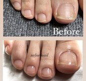 ネルネルネイル(nel nel nail)