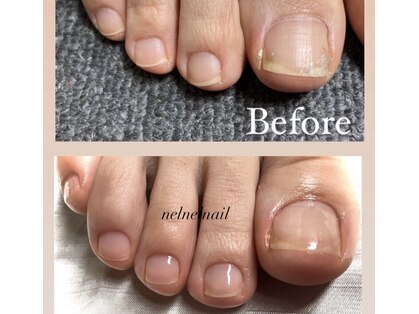 ネルネルネイル(nel nel nail)の写真