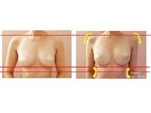 ココシア 取手店(COCOCIA)/バストアップ症例★