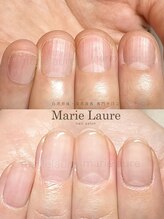 マリーロール 梅田店(Marie Laure)/深爪矯正/自爪育成/自爪風