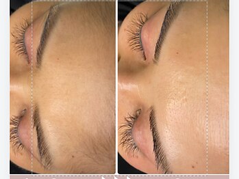 アリュール(Allure)/フェイシャルWax