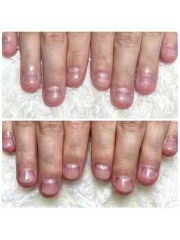 ココモ(cocomo)の写真/深爪矯正で美しいネイルを実現!長さだしとフィルインで長持ち仕上げ。他店との違いをお確かめください♪