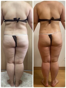 プラム(plum)/セルゼロ2