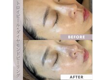 スウィート 矢場町店(Sweet)の雰囲気（ダイヤモンドの様な艶肌になる肌管理メニューもあります！）
