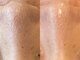 ニカ(Nica.)の写真/ハーブピーリング×毛穴洗浄で肌を整える!毛穴丸ごと洗浄でなめらか肌に導く特別なケア体験。