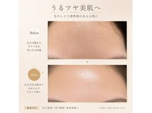 エステティック レイビス 銀座店(RAYVIS)の雰囲気(ホワイトニング/毛穴小顔/シェービング脱毛/銀座ヘッドスパ)