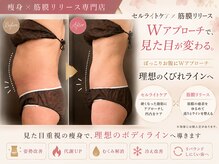 ナビ(NABI)
