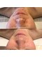 シグネット(Cygnet)の写真/ニキビやニキビの後の赤みは当サロンが強い!敏感肌や乾燥肌は美容医療じゃ治らない。実力サロンにお任せ